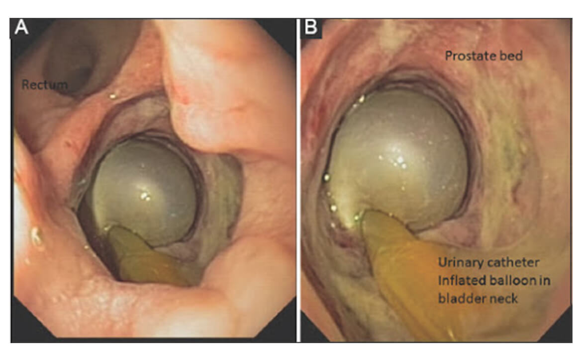Best Pediatric Urologist in India, Robotic pediatric urology